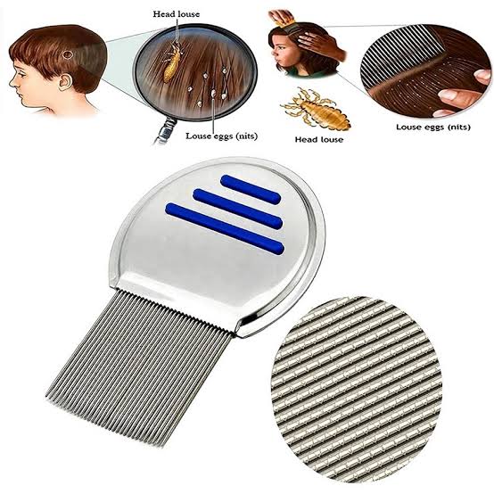 Lice Comb (Stainless Steel) – উকুন পরিষ্কারের কার্যকর চিরুনি